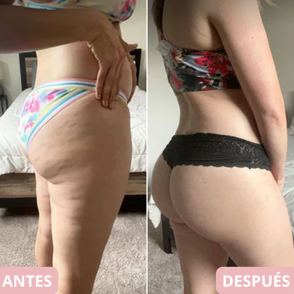 <p>Cambia tu cuerpo y reafirma tu piel en 10 min… +5.000 <strong>Testimonios Verificados lo Respaldan</strong></p>