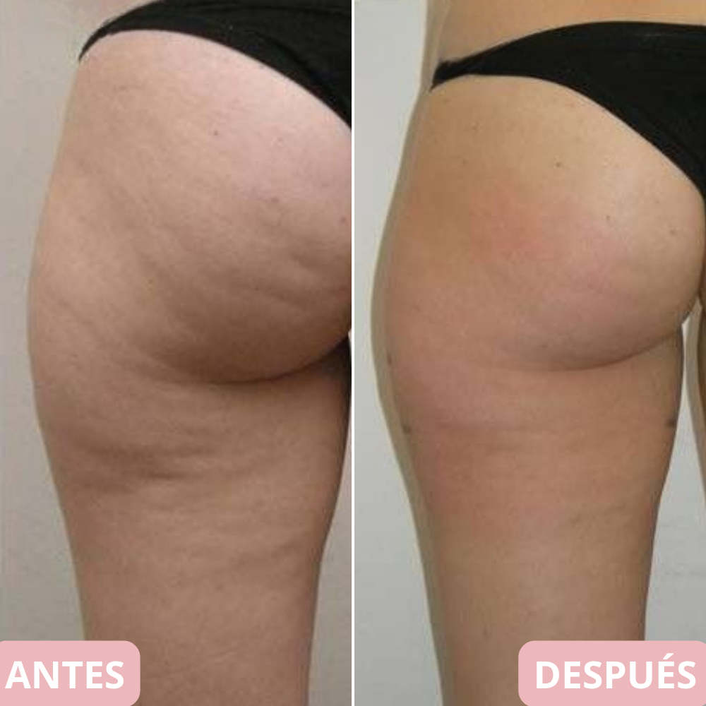 <p>Cambia tu cuerpo y reafirma tu piel en 10 min… +5.000 <strong>Testimonios Verificados lo Respaldan</strong></p>