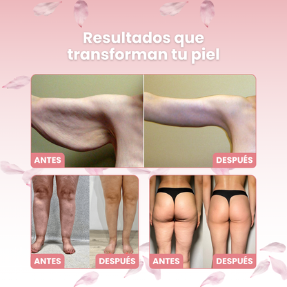 RedSculpit® | Tecnología Estética Concentrada. El poder puro del vacío terapéutico y la luz roja infrarroja en cada sesión de 10 minutos