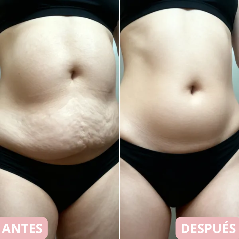 <p>Cambia tu cuerpo y reafirma tu piel en 10 min… +5.000 <strong>Testimonios Verificados lo Respaldan</strong></p>