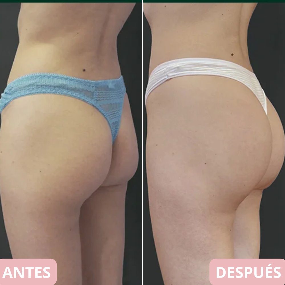 <p>Cambia tu cuerpo y reafirma tu piel en 10 min… +5.000 <strong>Testimonios Verificados lo Respaldan</strong></p>