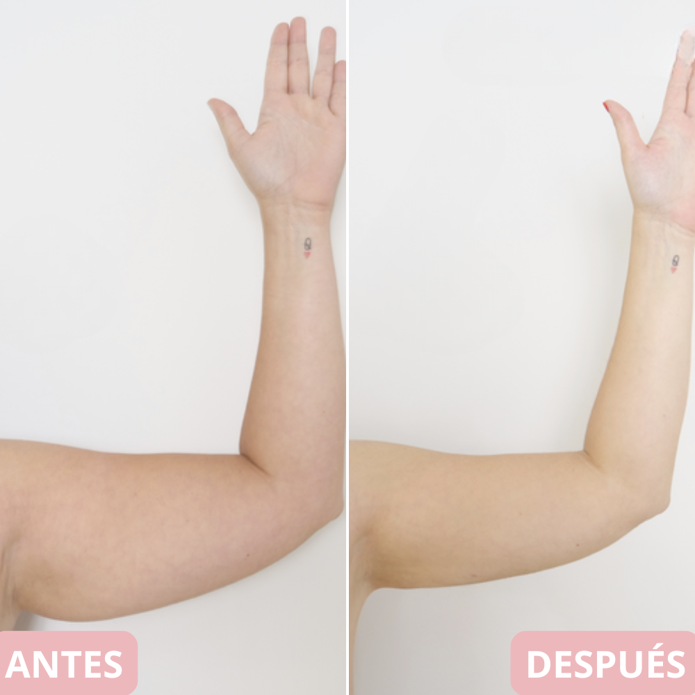 <p>Cambia tu cuerpo y reafirma tu piel en 10 min… +5.000 <strong>Testimonios Verificados lo Respaldan</strong></p>
